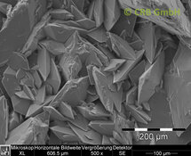 Nierensteine aus Calciumoxalat | © CRB Analyse Service GmbH